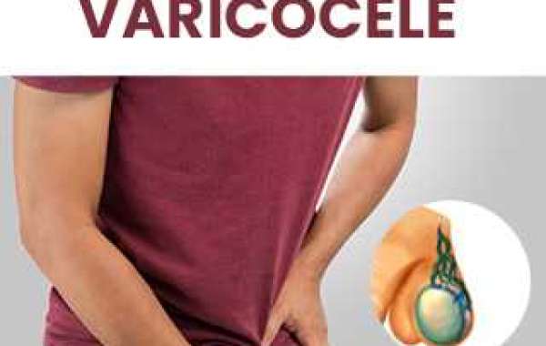 Natural Healing for Varicocele: The Ultimate Homeopathic Treatment Guide